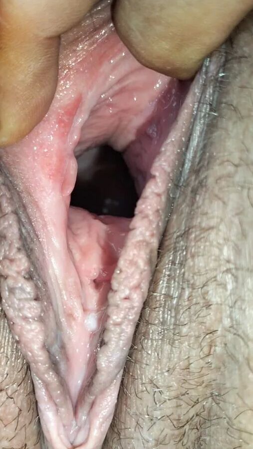 Cum covered cervix
