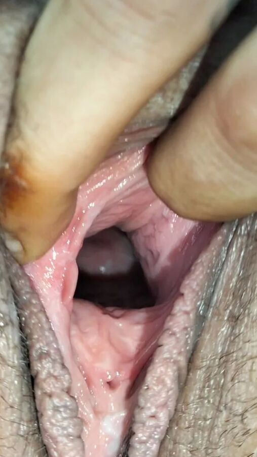 Cum covered cervix