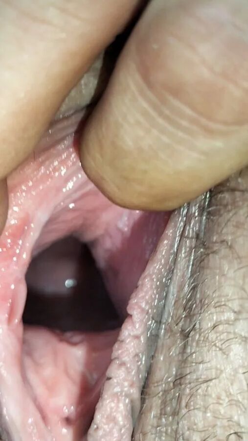 Cum covered cervix