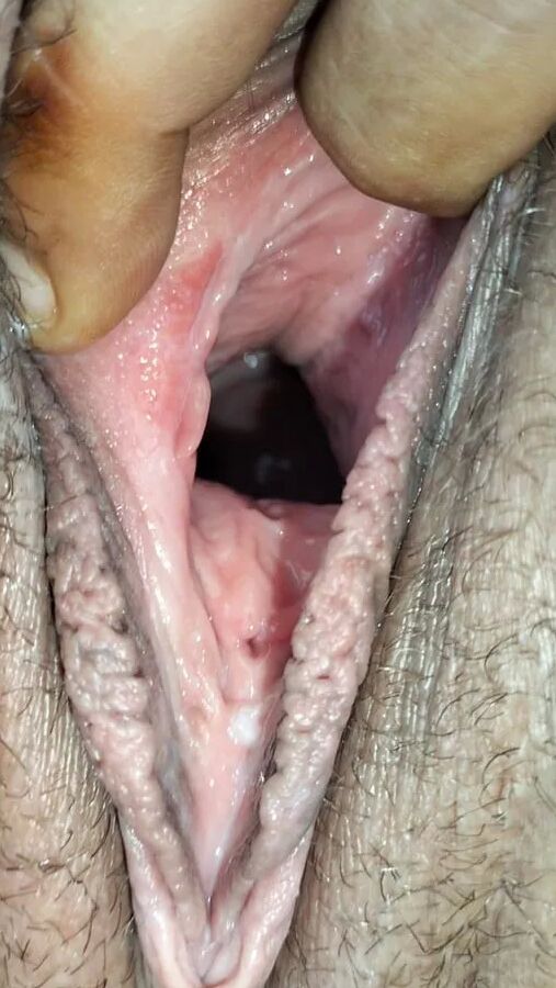 Cum covered cervix