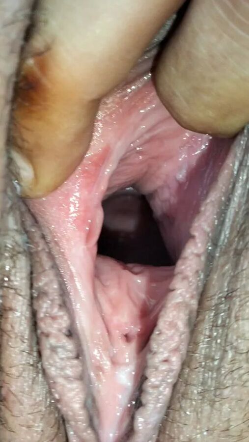 Cum covered cervix