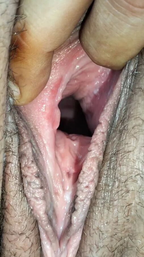 Cum covered cervix