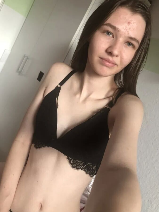 18yo skinny German Teen Girl, small tits, huge labia