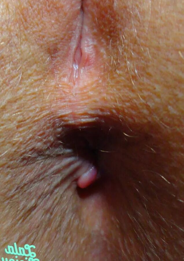My Brown Eye
