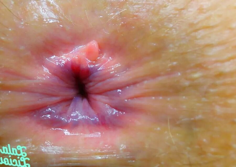My Raw Blue Butt Hole Love The Shades