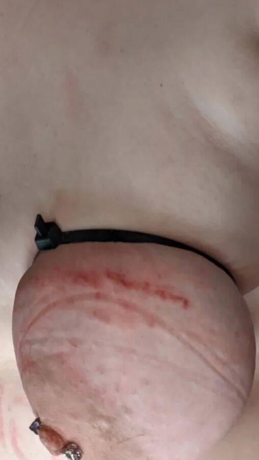 Pain