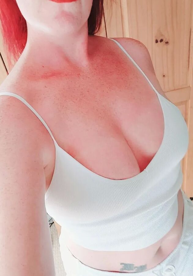 Redhead