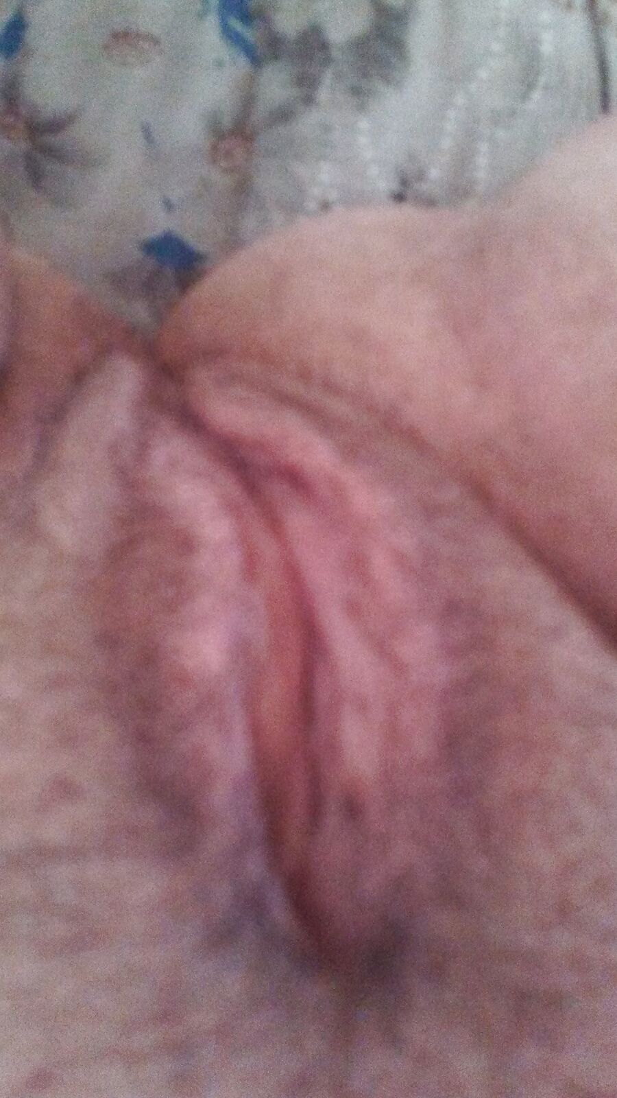 More pics