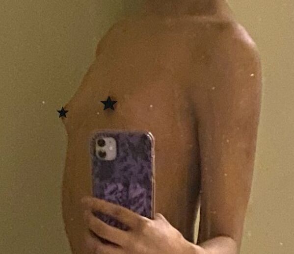 Shylidia nude