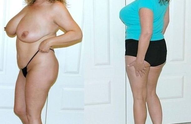 dressed &amp; undressed