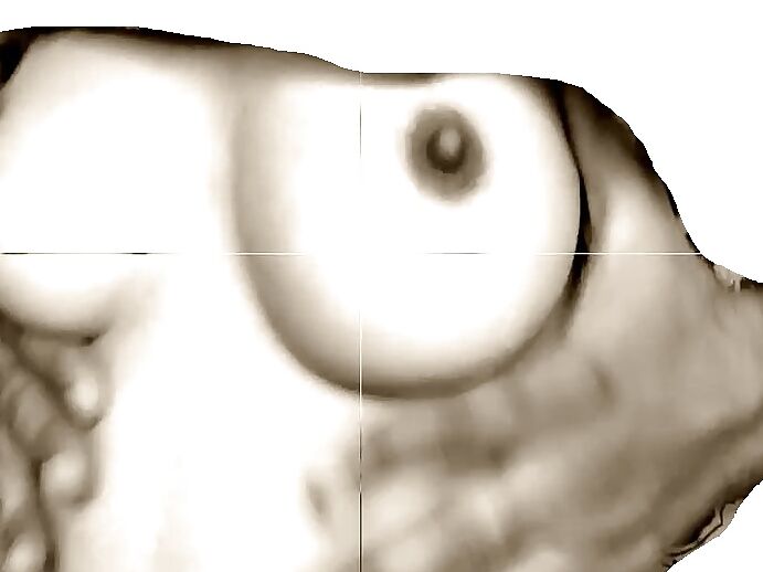 BOOB VALLEY