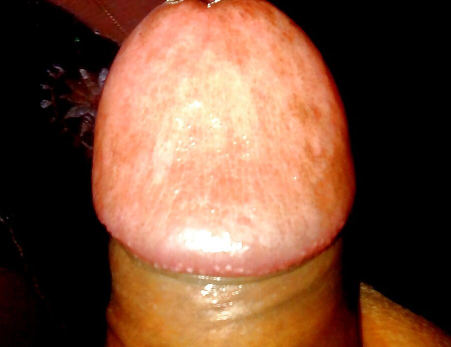 My dick version