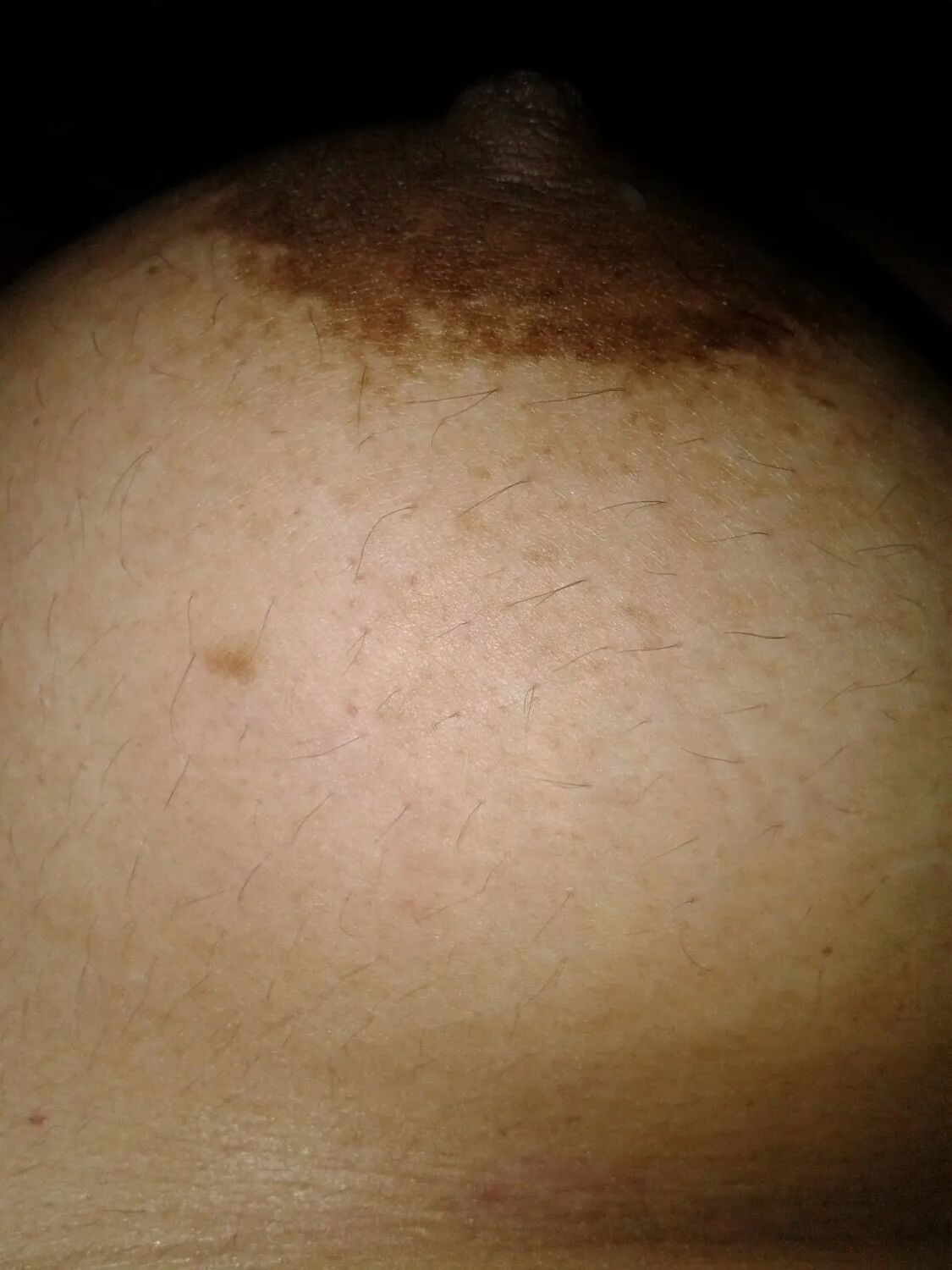 Night Fun - 5 Pics