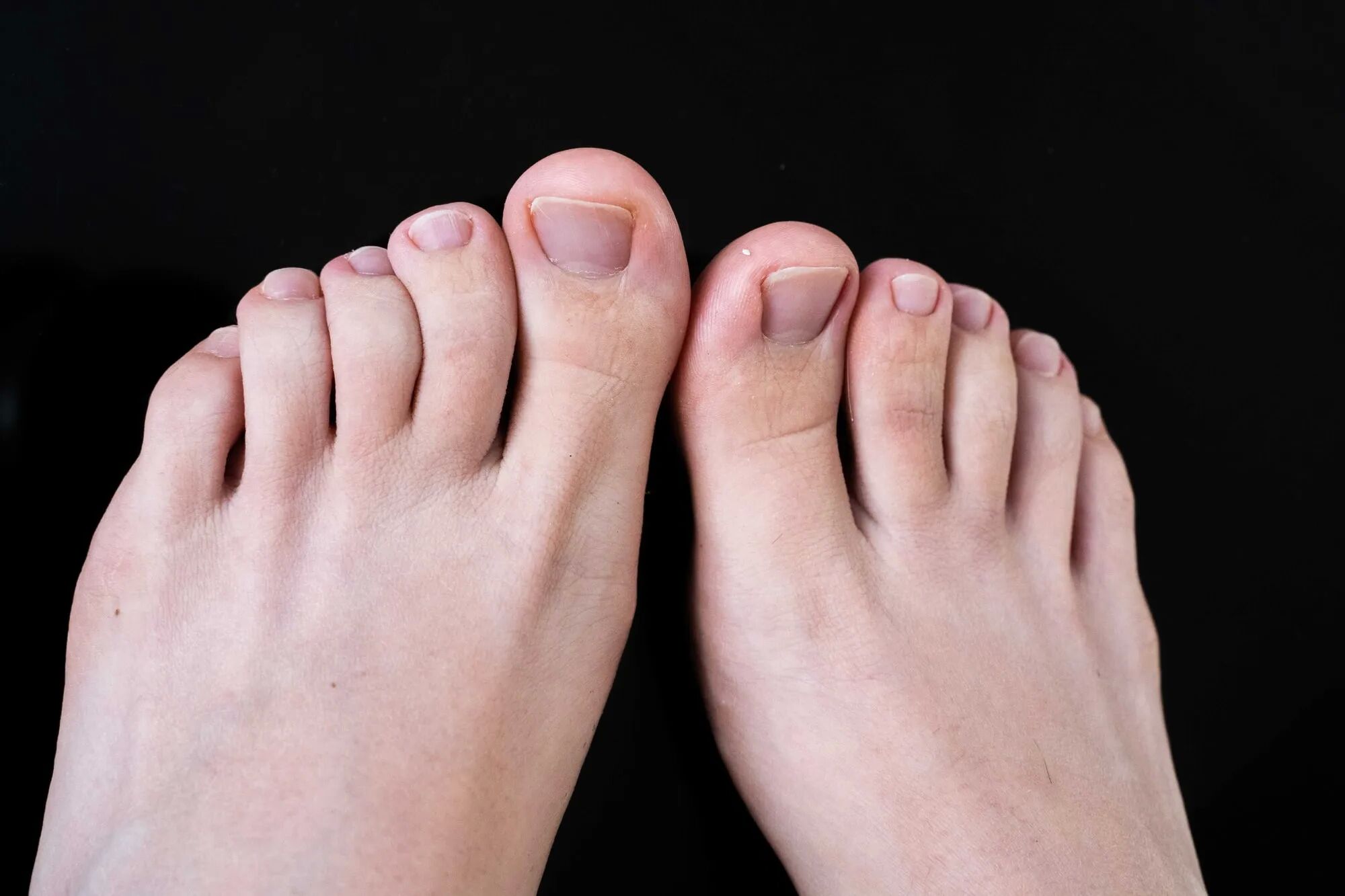 Feet - 7 Pics