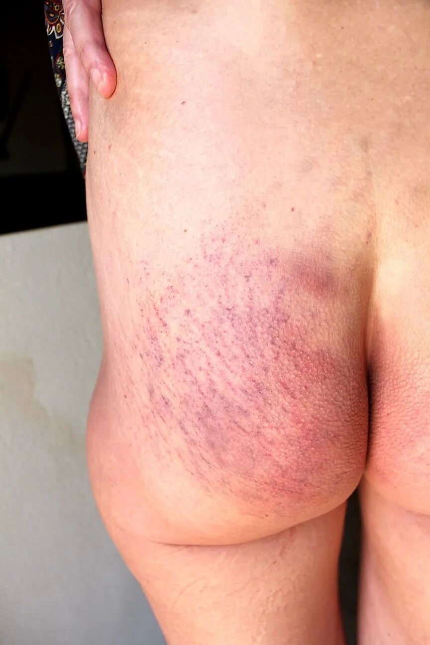 Cropped ass next morning - 5 Pics