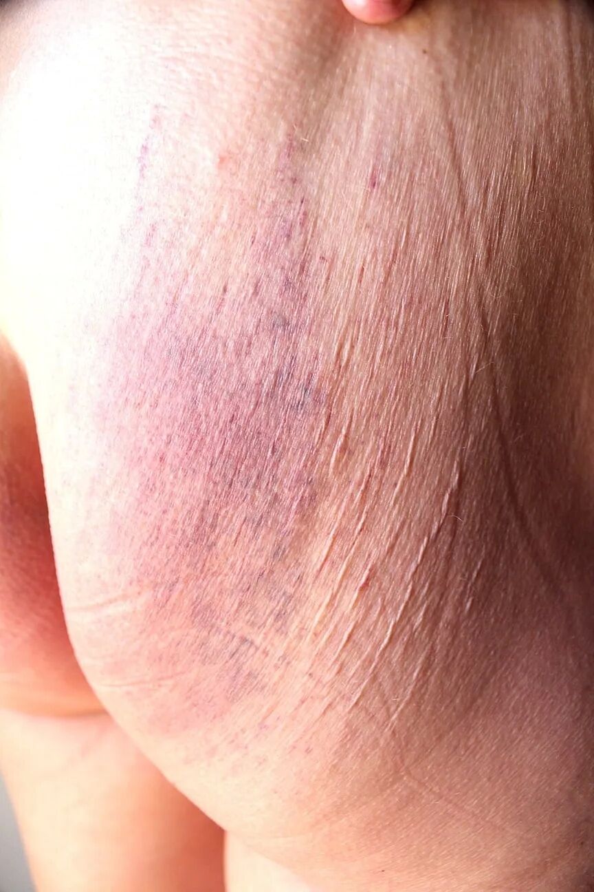 Cropped ass next morning - 5 Pics