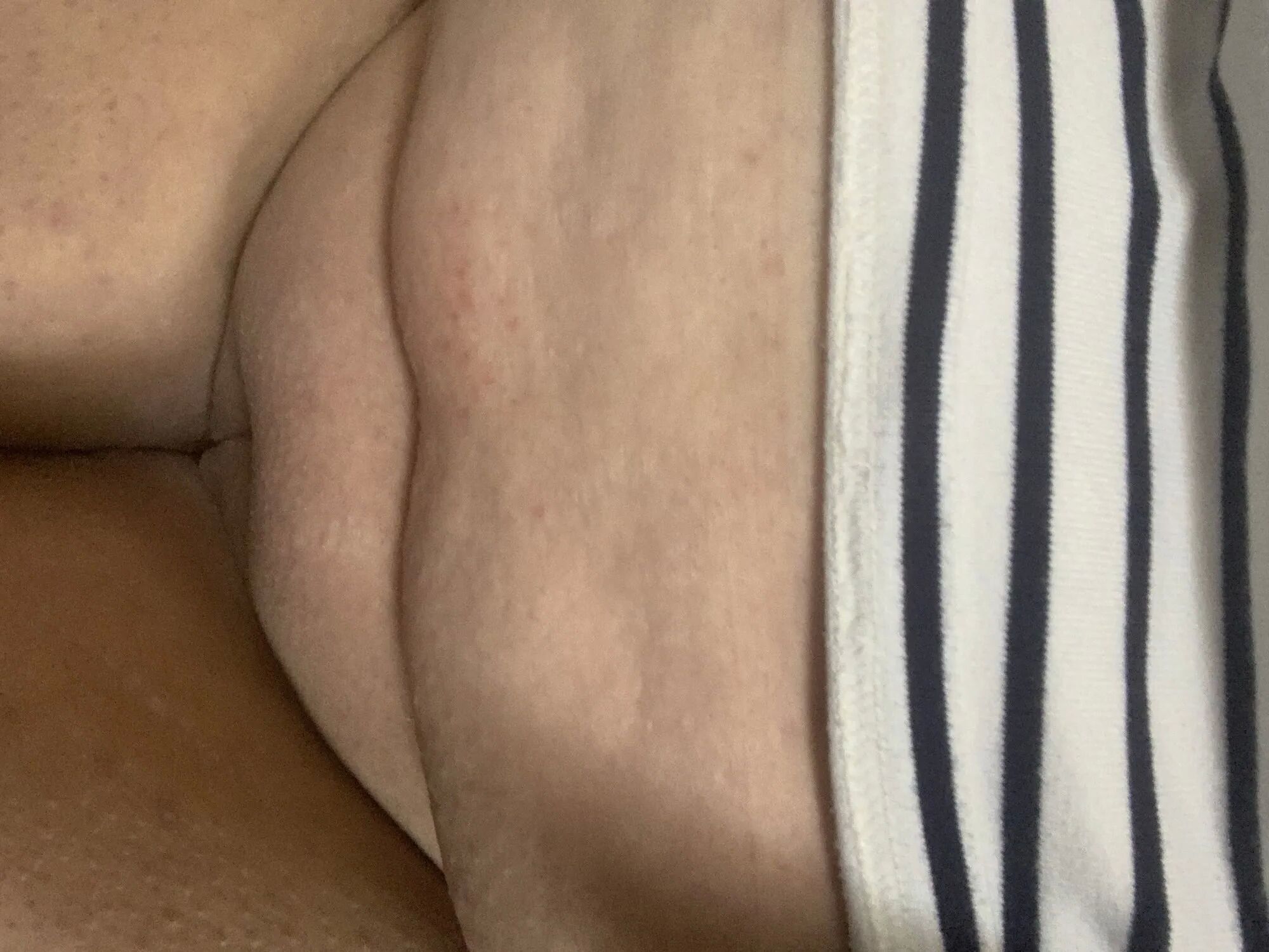 Any takers? - 35 Pics