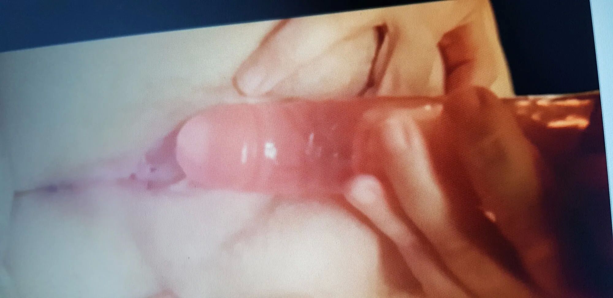 New pictures of my husband's little cock, it's so nice to su - 56 Pics