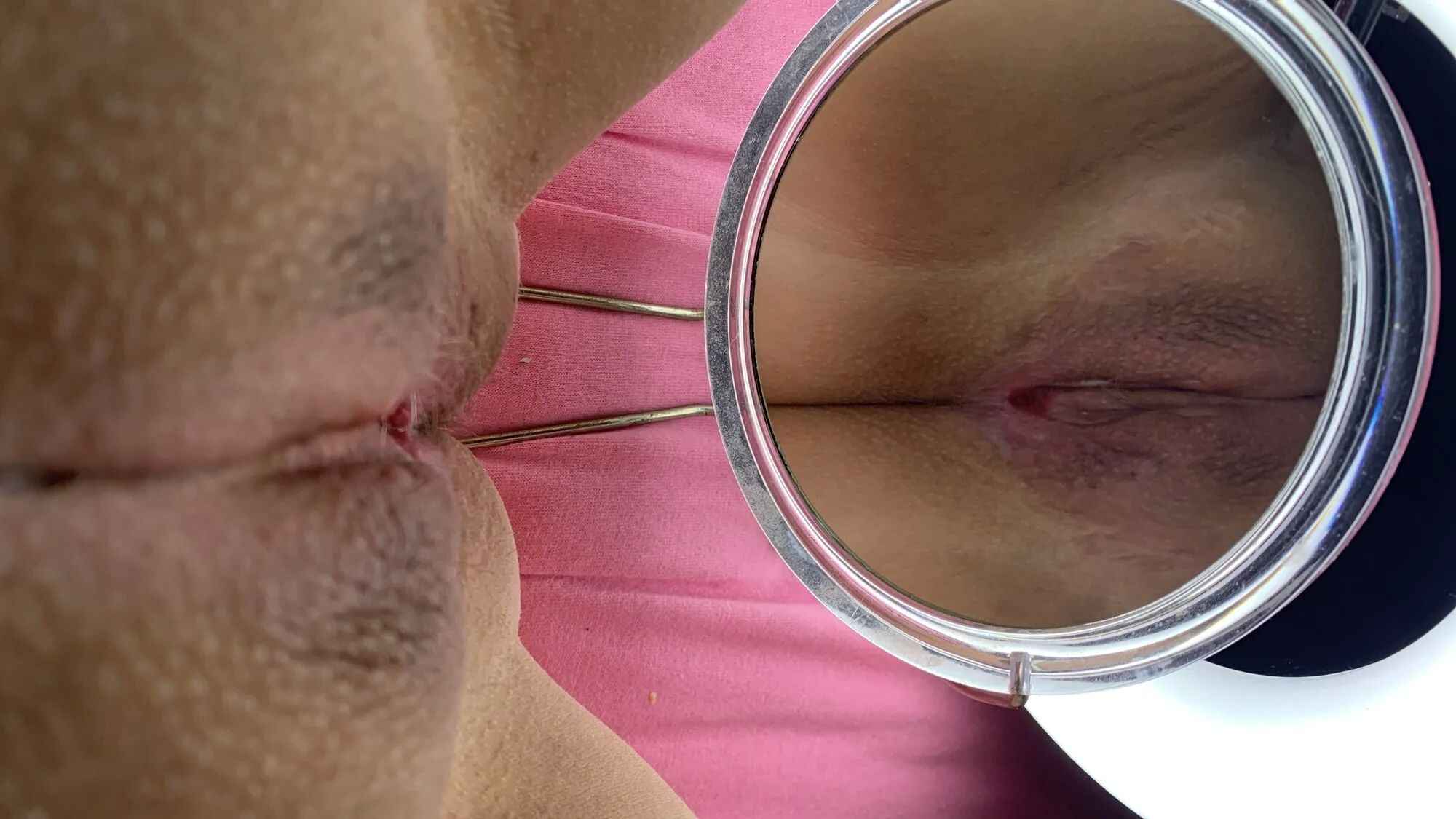 Postoperative Sklavin - 13 Pics