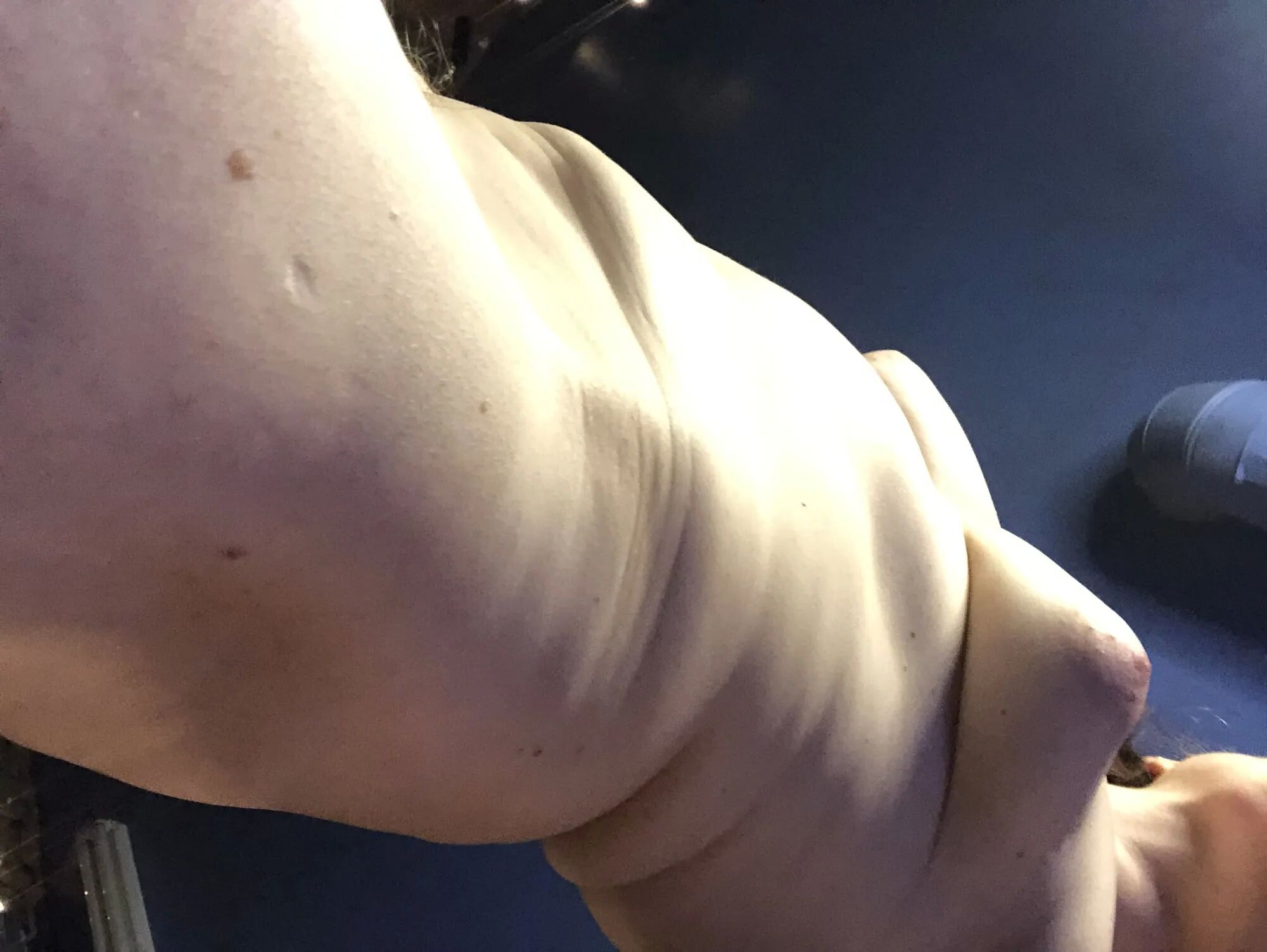 Vulnerability corner! Unique body, unique being. - 16 Pics