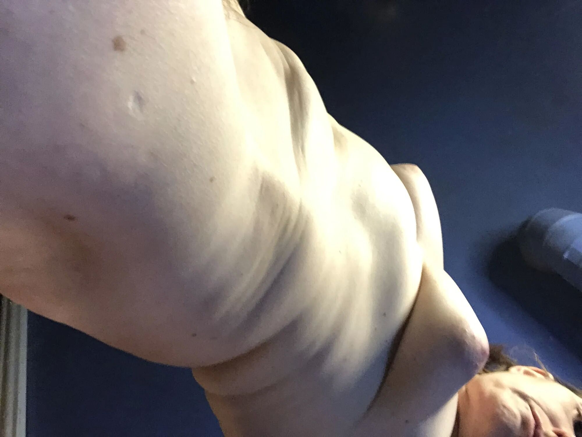 Vulnerability corner! Unique body, unique being. - 16 Pics