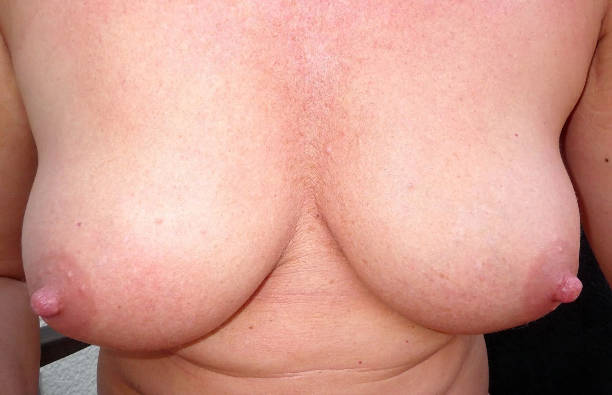 My Tits - 1 - 30 Pics