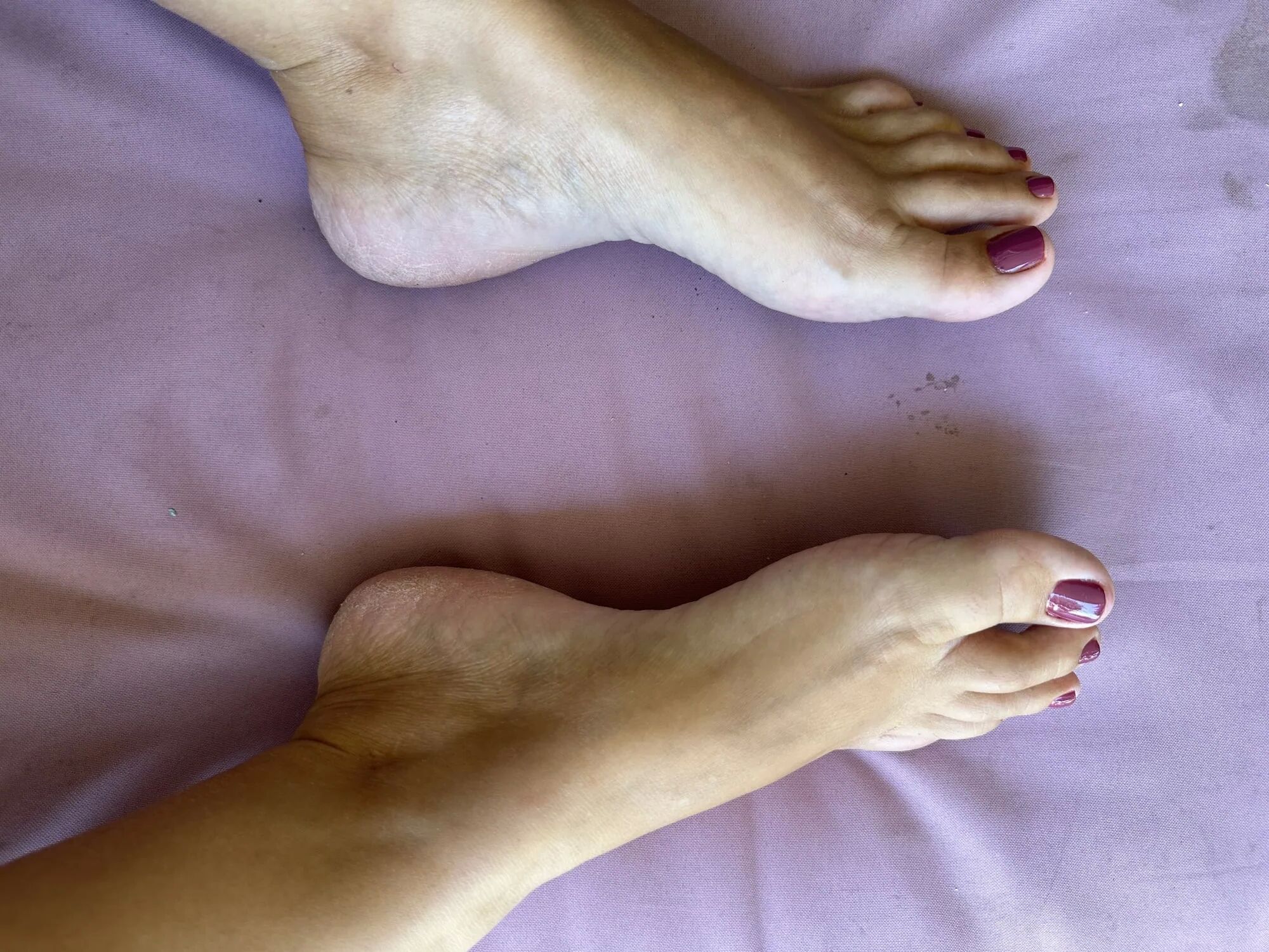 My little feet - 20 Pics