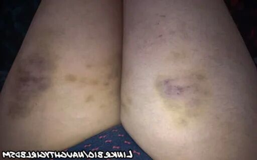 Marks of punishments - 22 Pics