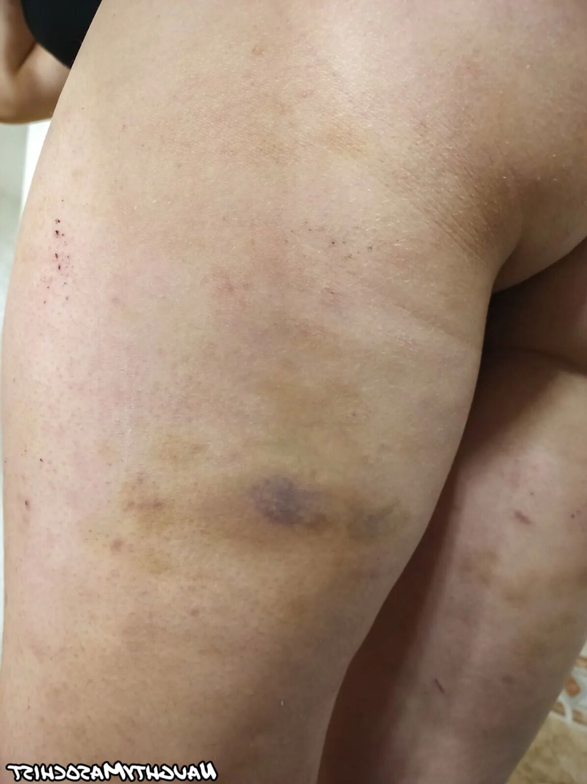 Marks of punishments - 22 Pics