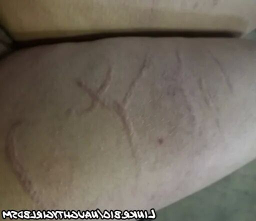 Marks of punishments - 22 Pics