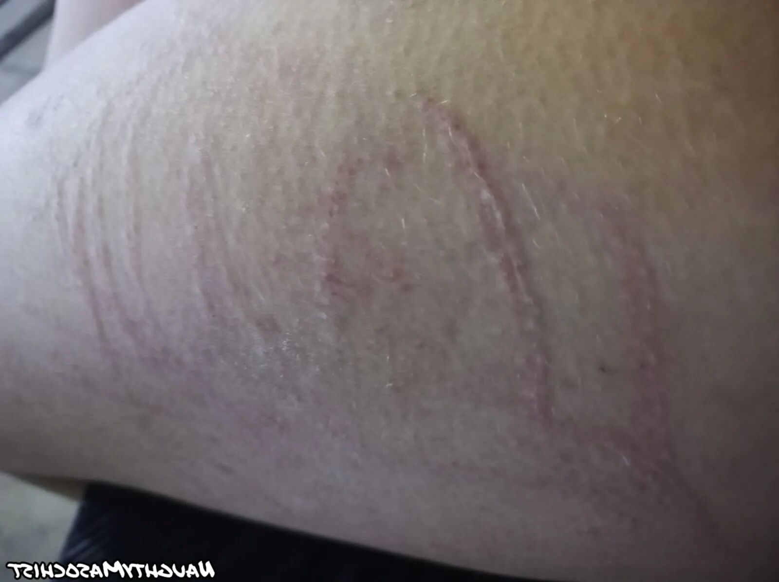 Marks of punishments - 22 Pics