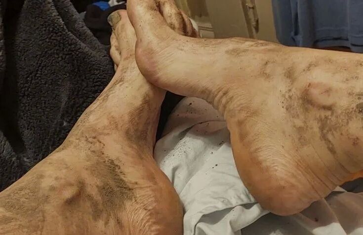 Feet - 18 Pics