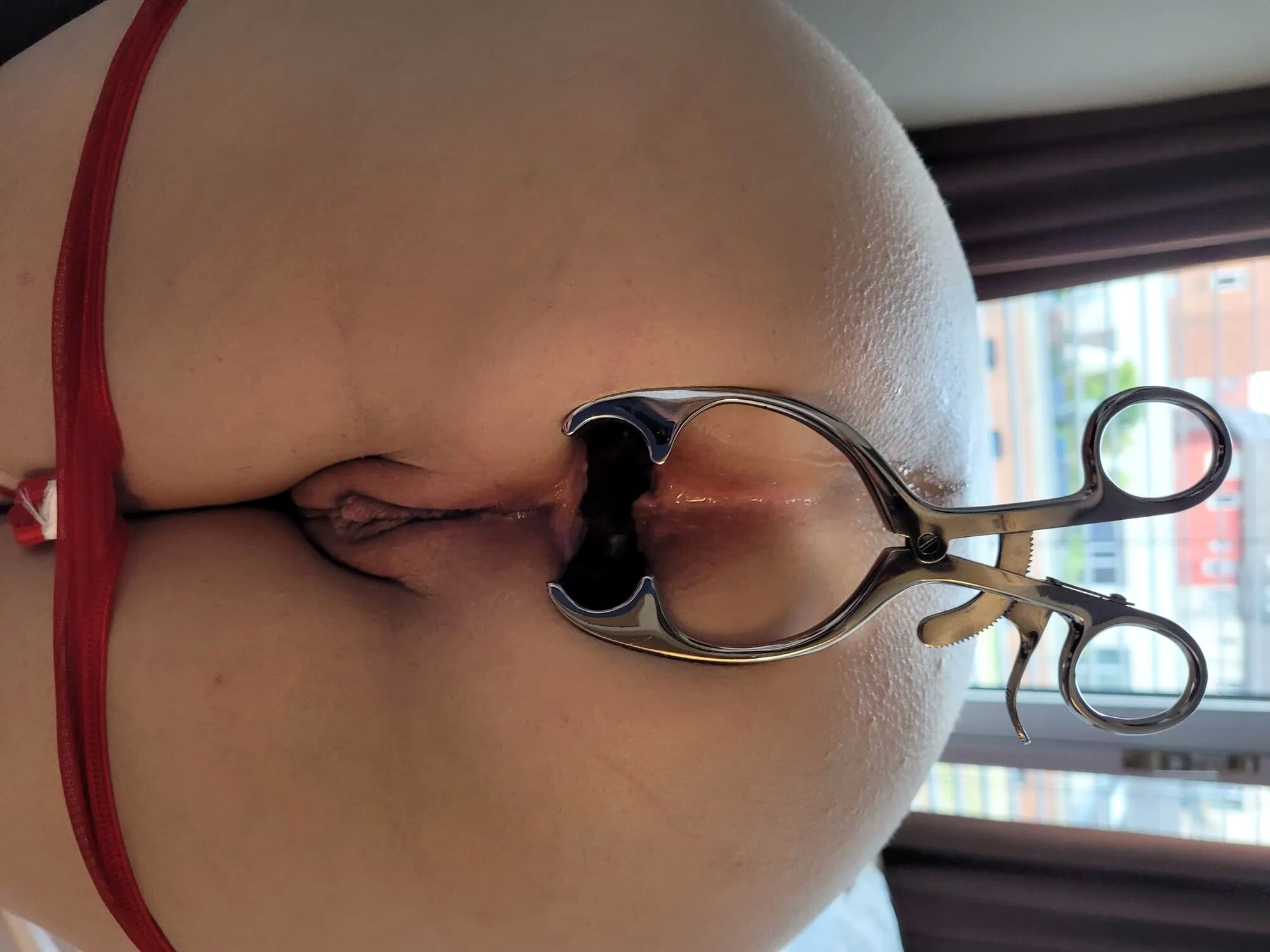 Huenin anal inspection in July - 10 Pics