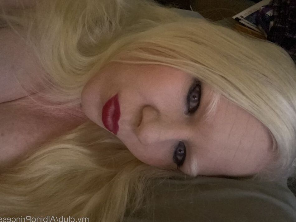 5 Pics Albino Princess Free Photos