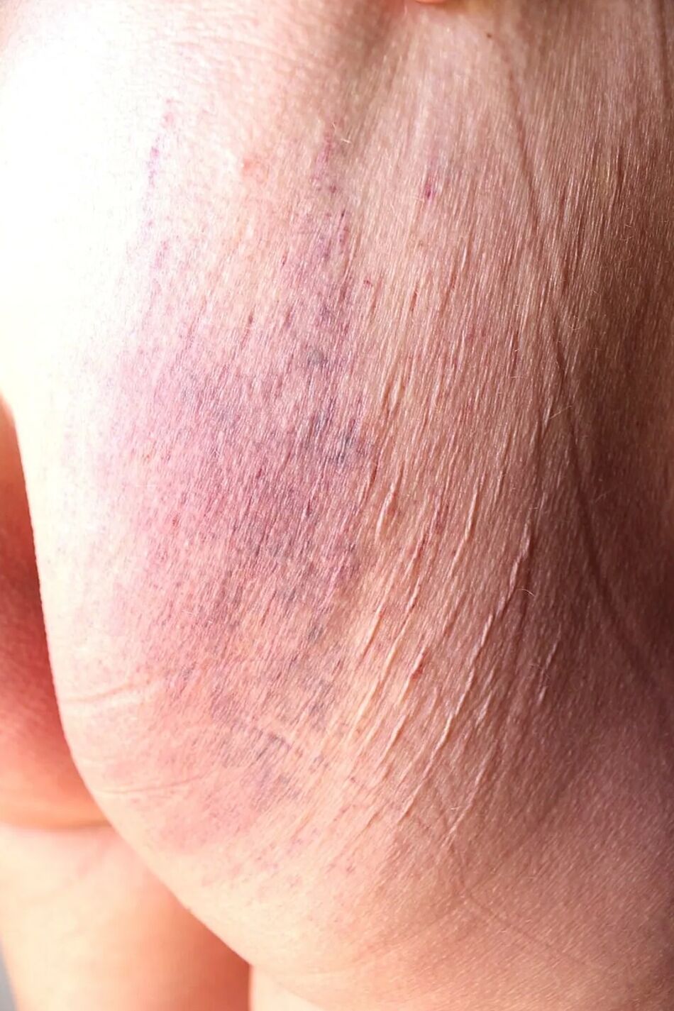 5 Pics cropped ass next morning