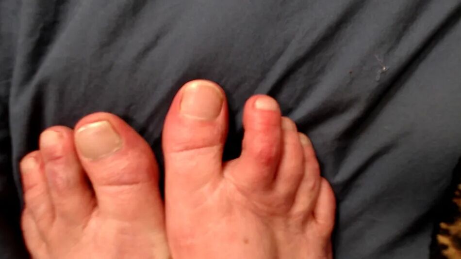 20 Pics DawnSkye has sexy feet