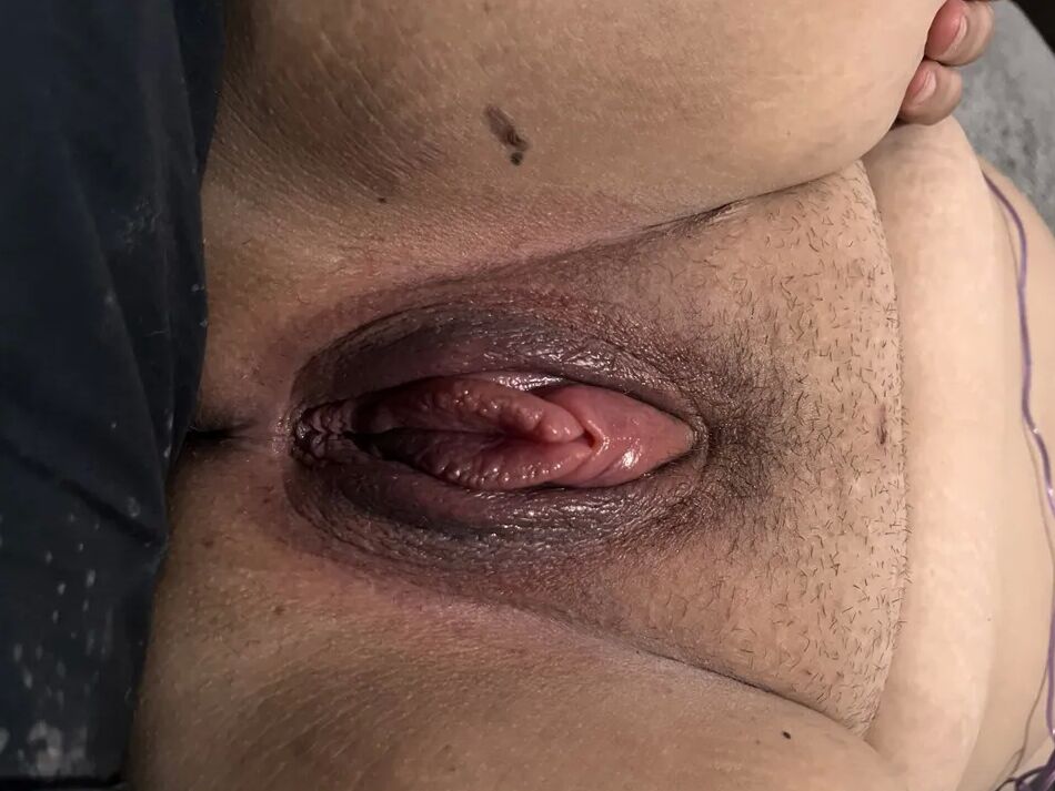 12 Pics Doctor insisted on pumping my wet stretched pussy for me