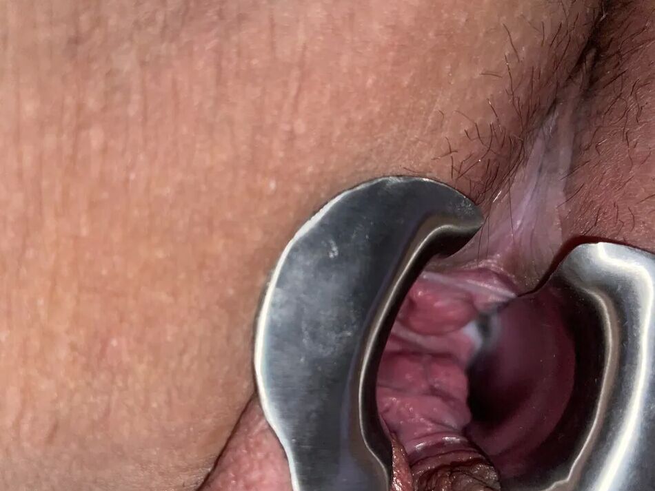 7 Pics Open up