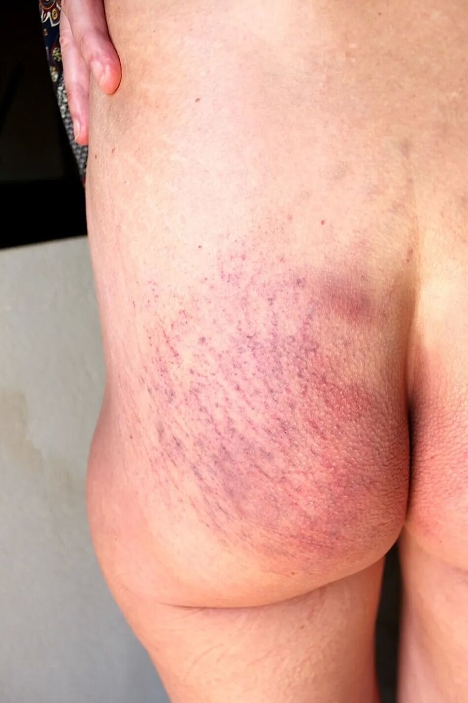 5 Pics cropped ass next morning