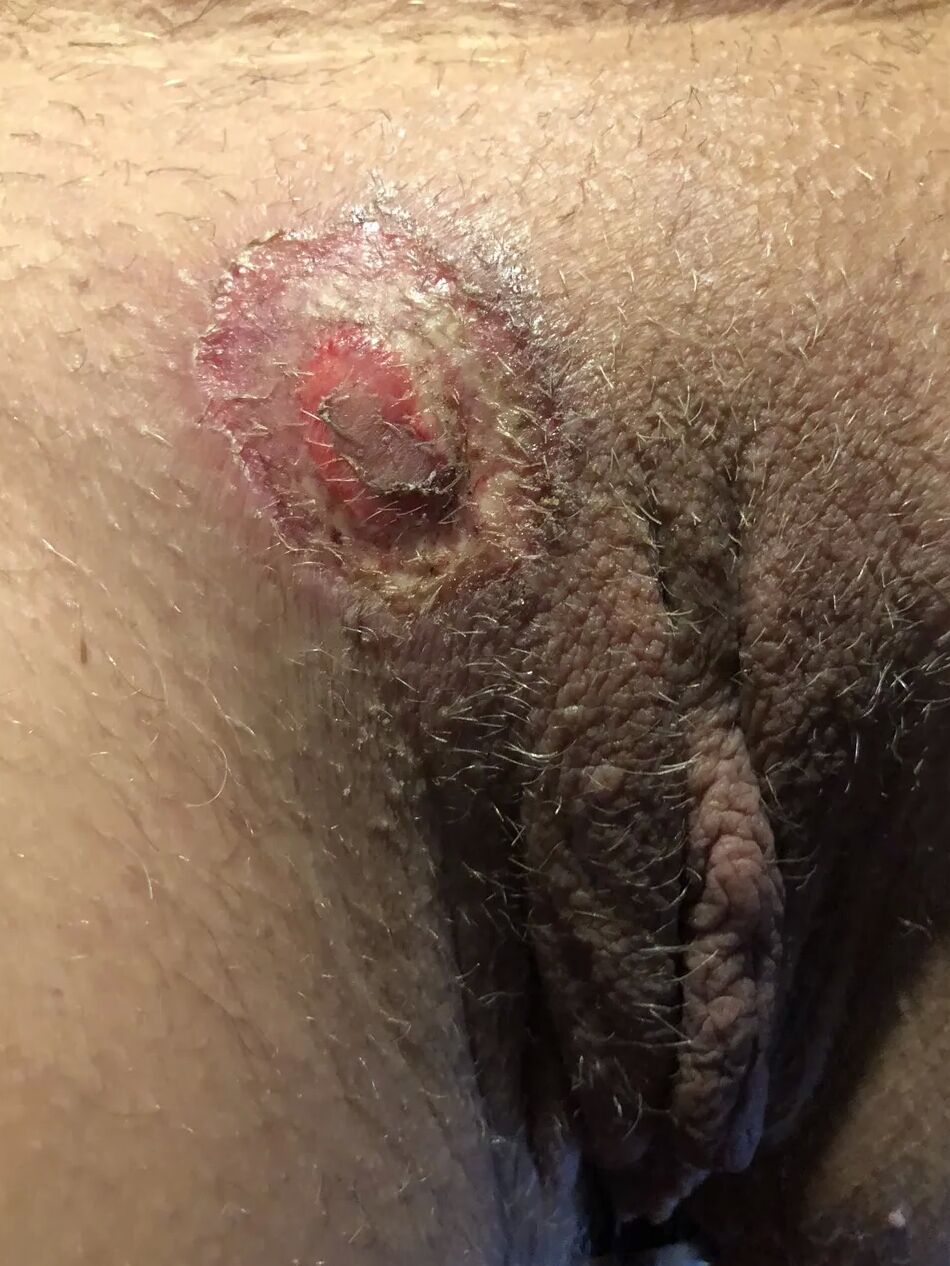 5 Pics My Pussy Branding