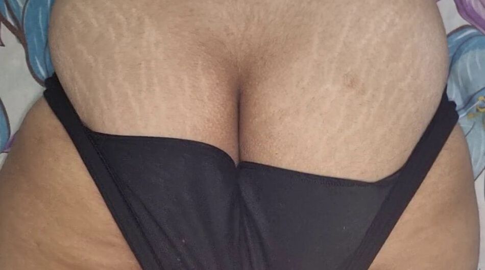 20 Pics Manvi "The Fat-ass" Ratra