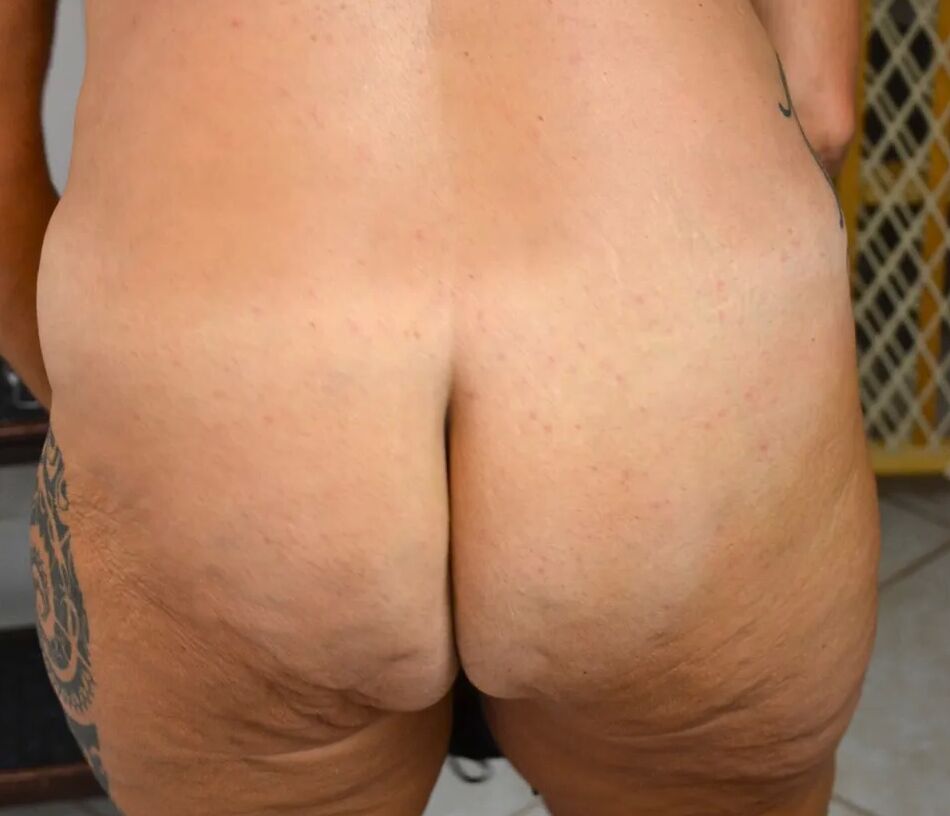 20 Pics fuck toy easy