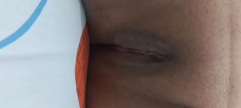 20 Pics Pics squirt