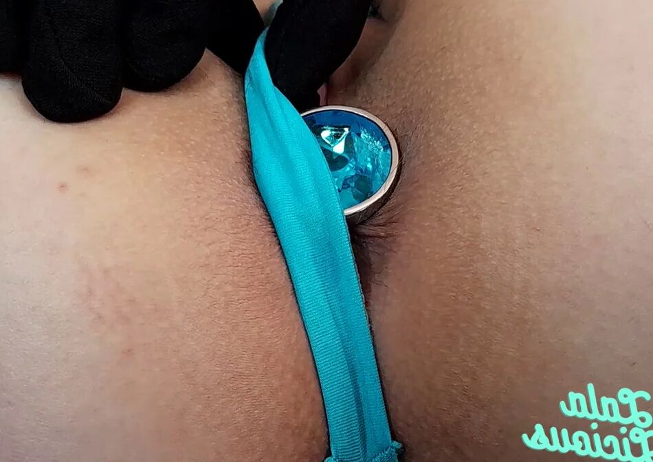 14 Pics Anal Gape Close-Up