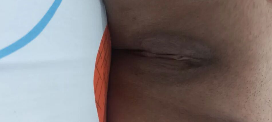 20 Pics Pics squirt