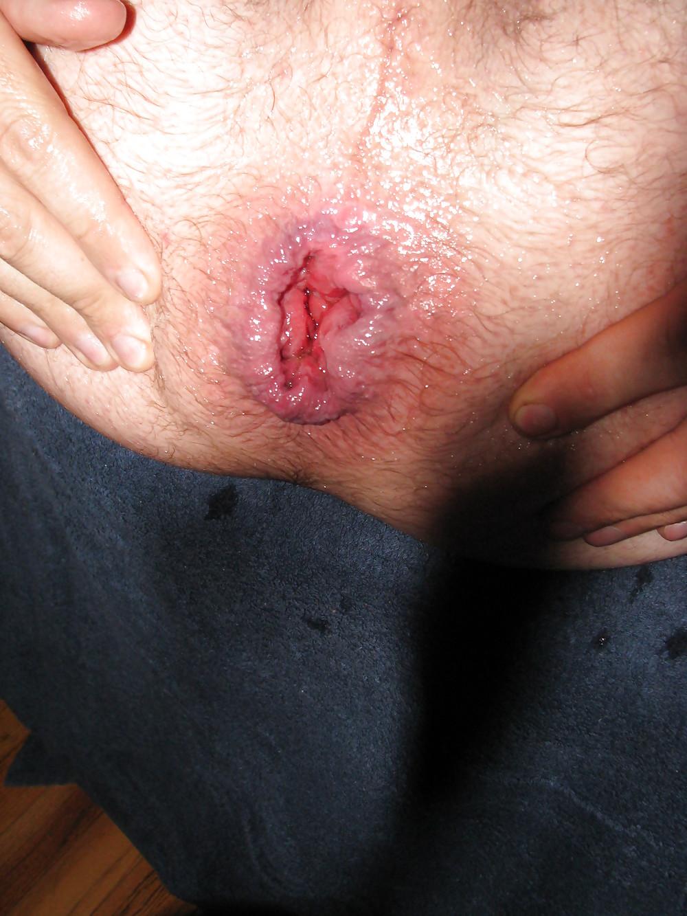 17P Love anal abuse and being mad a bitch