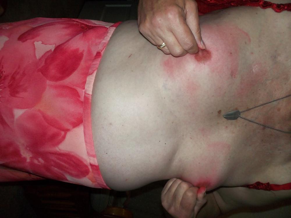 25P Nipple abuse for Master