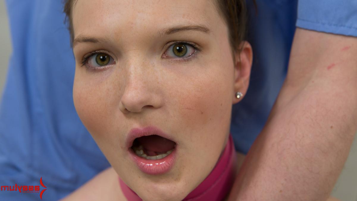 16P Bound anal torutre