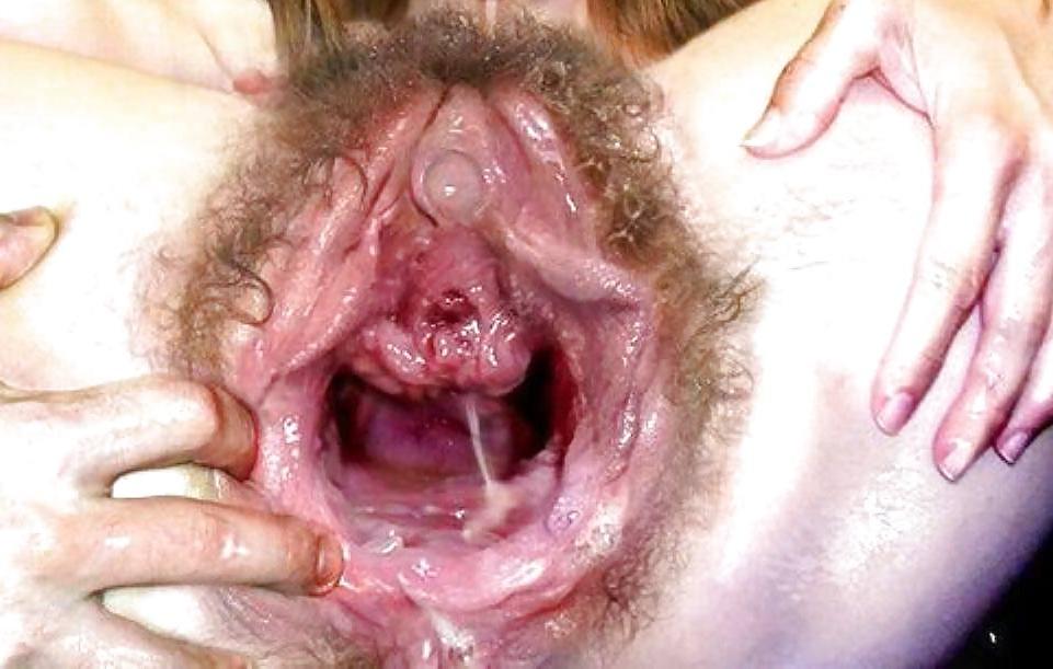 25P ALL AMATEURS: EXTREME GAPING HOLES! -L1390-