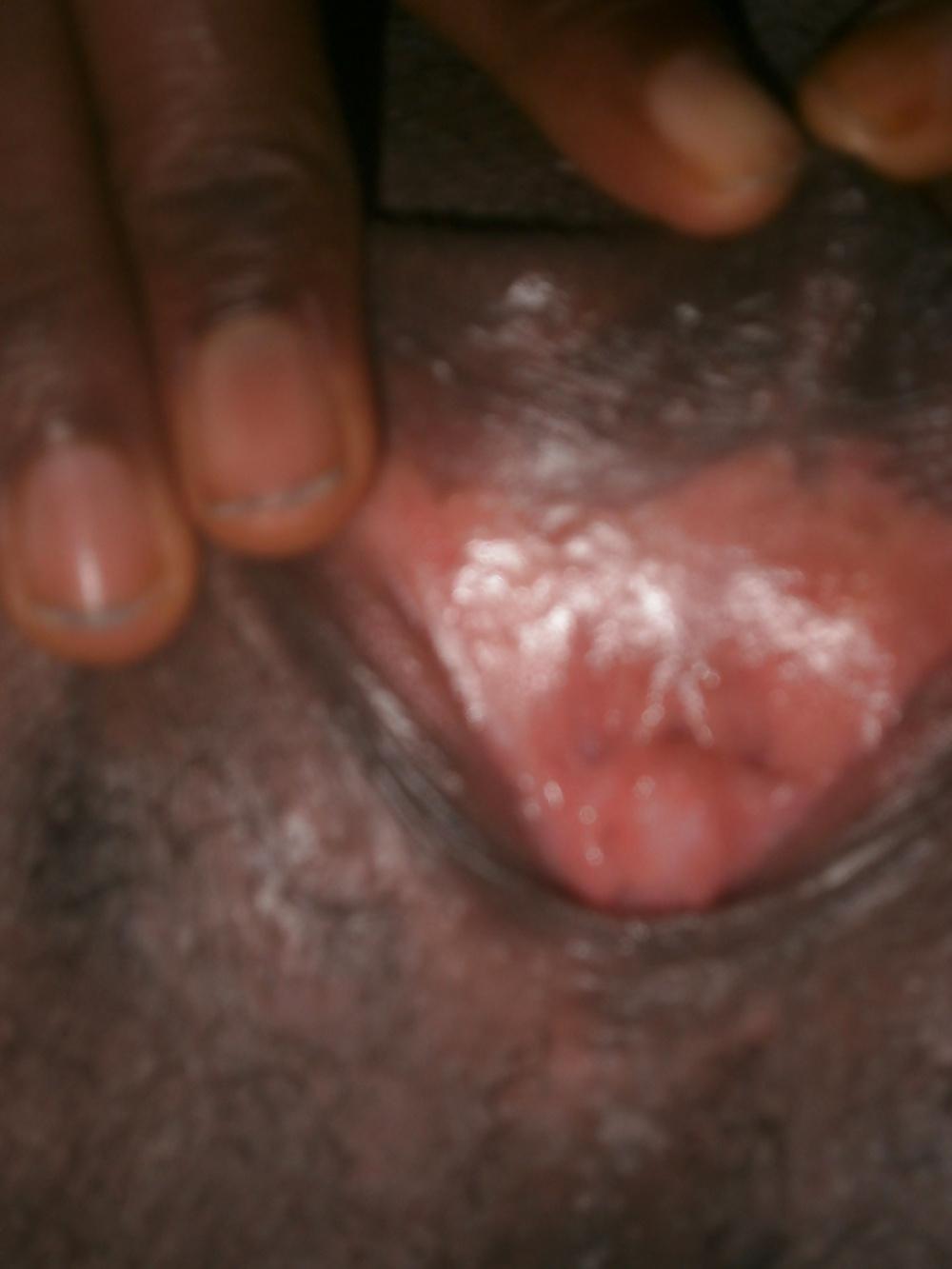 25P West african pussy 2